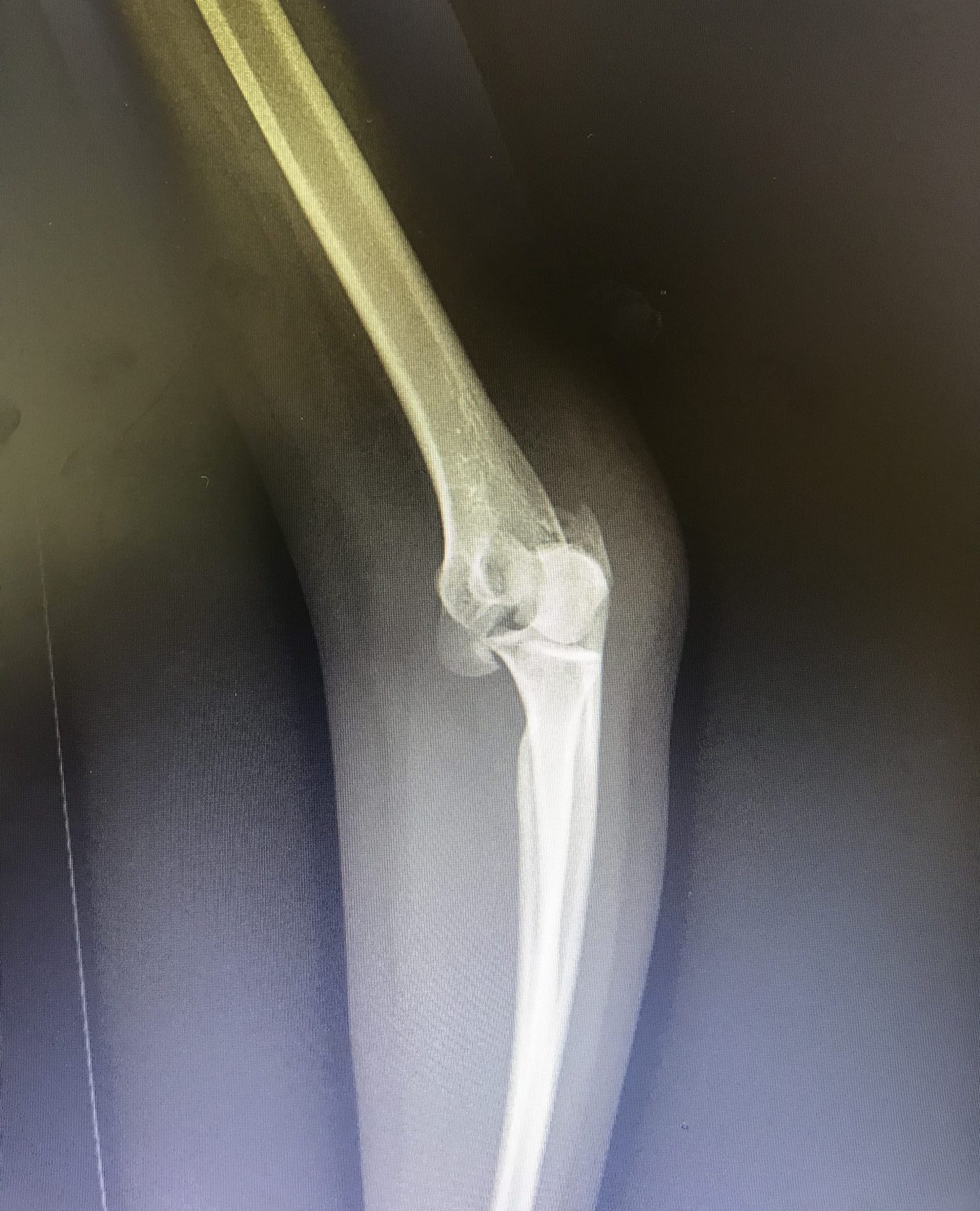 Before Surgery