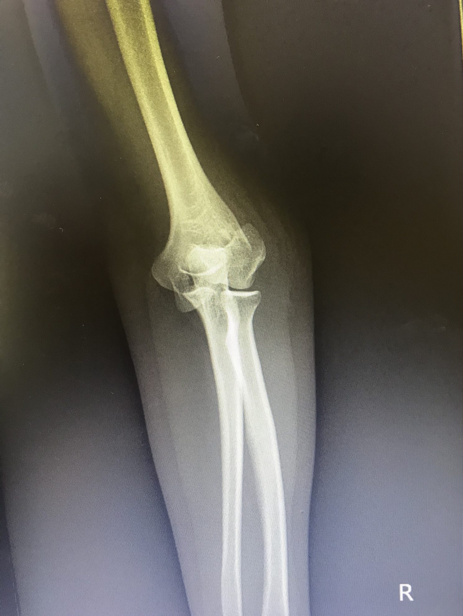 Before Surgery