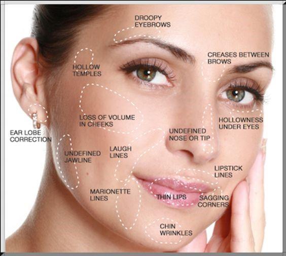 Botox and Fillers: Are they the same??