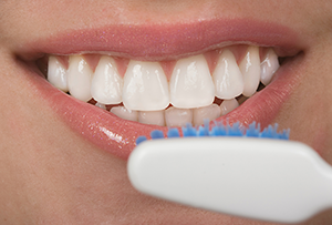 Dental Bonding