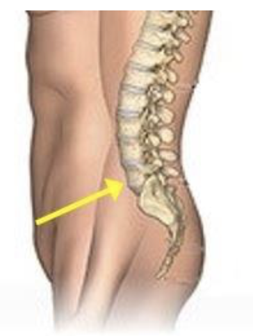 Anterior Lumbar Interbody Fusion