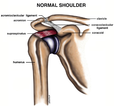 shoulder tendonitis