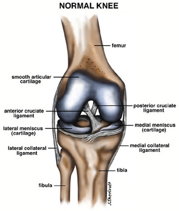 Arthroscopic picture of left knee revealing (a) bulky anterior cruciate