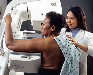 Mammogram screening