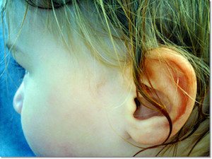 Is it colic or something more serious? Are they just trying to get out of going to school today? Familiarize yourself with these ear infection symptoms.