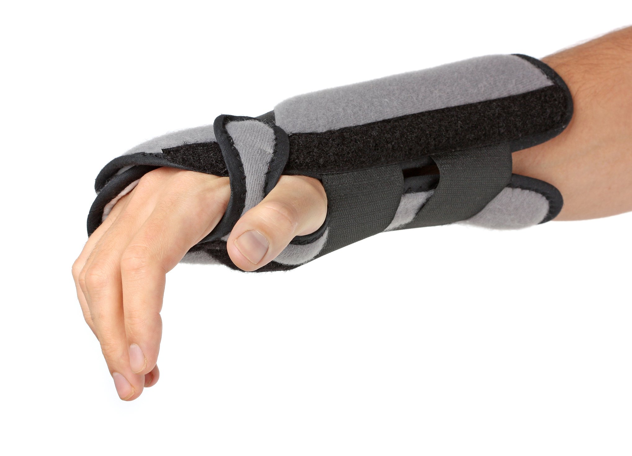 Carpal Tunnel Syndrome and Causes